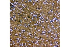 Immunohistochemistry (IHC) image for anti-Synaptotagmin I (SYT1) antibody (ABIN5692948)
