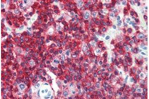 Anti-CD45RA antibody IHC staining of human spleen. (CD45RA 抗体  (FITC))