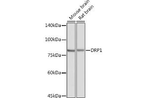 Western Blotting (WB) image for anti-Dynamin 1-Like (DNM1L) (AA 411-710) antibody (ABIN3023670)