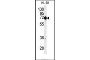 Western blot analysis of Complex IV subunit I Antibody  in HL-60 cell line lysates (35ug/lane). (Complex IV Subunit I (AA 202-232), (Middle Region) 抗体)