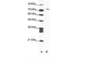 Image no. 1 for anti-Mastermind-Like Domain Containing 1 (MAMLD1) (AA 180-229) antibody (ABIN202873) (MAMLD1 抗体  (AA 180-229))