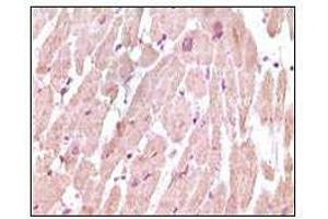 Immunohistochemical analysis of paraffin-embedded human normal cardiac muscle tissue, showing cytoplasmic localization using cTnI antibody with DAB staining. (TNNI3 抗体)