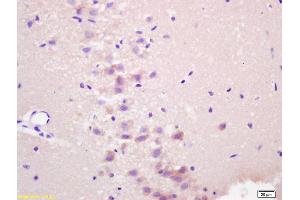 Formalin-fixed and paraffin embedded rat brain labeled with Anti-RASSF1A Polyclonal Antibody, Unconjugated (ABIN673764) at 1:200 followed by conjugation to the secondary antibody and DAB staining. (RASSF1 抗体  (AA 145-260))