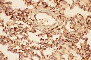 Immunohistochemistry (IHC) image for anti-Cofilin 1 (CFL1) (AA 2-166) antibody (ABIN3042747)