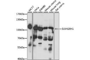 Western blot analysis of extracts of various cell lines, using SUV420H1 antibody (ABIN7270648) at 1:1000 dilution. (SUV420H1 抗体  (AA 100-200))