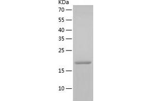 RHOC Protein (AA 1-190) (His tag)