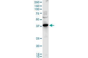 PXMP3 polyclonal antibody (A01), Lot # 051031JC01. (PEX2 抗体  (AA 217-305))