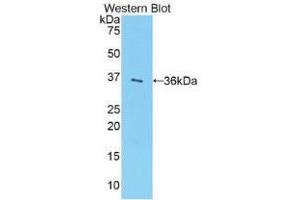 Western blot analysis of the recombinant protein. (SULT1A1 抗体  (AA 3-291))
