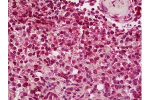 Anti-BCAR1 / p130Cas antibody IHC staining of human spleen. (BCAR1 抗体  (AA 275-325))