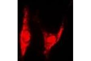 Immunofluorescent analysis of PSMD8 staining in U2OS cells. (PSMD8 抗体)
