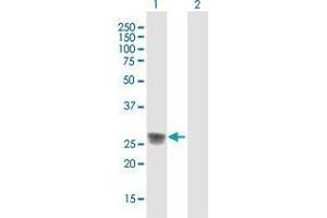 Western Blot analysis of C1QA expression in transfected 293T cell line by C1QA MaxPab polyclonal antibody. (C1QA 抗体  (AA 1-245))