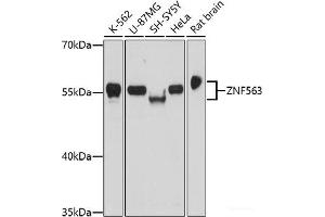 Western blot analysis of extracts of various cell lines using ZNF563 Polyclonal Antibody at dilution of 1:1000. (ZNF563 抗体)