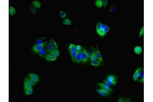 Immunofluorescent analysis of HepG2 cells using ABIN7153987 at dilution of 1:100 and Alexa Fluor 488-congugated AffiniPure Goat Anti-Rabbit IgG(H+L) (NMDAR2A 抗体  (AA 501-750))