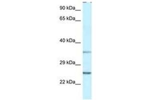 Image no. 1 for anti-Protein Phosphatase 1, Regulatory (Inhibitor) Subunit 2 (PPP1R2) (AA 27-76) antibody (ABIN6747489) (PPP1R2 抗体  (AA 27-76))