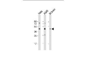All lanes : Anti-G6PC3 Antibody (C-Term) at 1:1000 dilution Lane 1: Hela whole cell lysate Lane 2: A549 whole cell lysate Lane 3: mouse brain lysate Lysates/proteins at 20 μg per lane. (G6PC3 抗体  (AA 215-246))