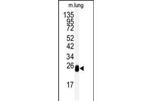Western blot analysis of anti-DCXR Antibody in mouse lung tissue lysates (35ug/lane) (Doublecortin 抗体  (AA 79-106))