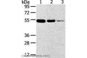 Western blot analysis of Human thyroid and esophagus cancer, human normal rectum tissue, using TMPRSS11F Polyclonal Antibody at dilution of 1:500 (TMPRSS11F 抗体)