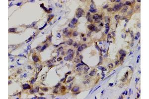 Immunohistochemistry (IHC) image for anti-Phosphoinositide 3 Kinase, p85 alpha (PI3K p85a) (pTyr607) antibody (ABIN6256775)