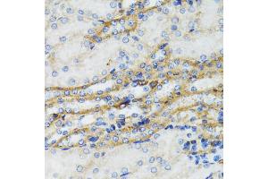 Immunohistochemistry of paraffin-embedded mouse kidney using SERPING1 antibody (ABIN6290125) at dilution of 1:100 (40x lens). (SERPING1 抗体)