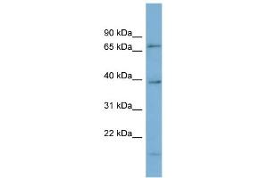 WB Suggested Anti-HP1BP3 Antibody Titration: 0. (HP1BP3 抗体  (Middle Region))