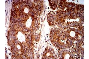 Immunohistochemistry (IHC) image for anti-Eukaryotic Translation Initiation Factor 5 (EIF5) (AA 1-300) antibody (ABIN5865324) (EIF5 抗体  (AA 1-300))