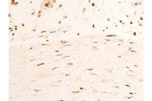 ABIN6267251 at 1/100 staining human gastric tissue sections by IHC-P.