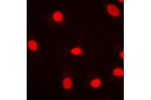 Immunofluorescent analysis of MZF1 staining in HeLa cells. (MZF1 抗体  (N-Term))
