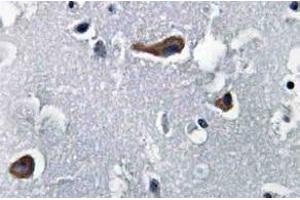 Immunohistochemistry (IHC) analyzes of MAP-2 antibody in paraffin-embedded human brain tissue. (MAP2 抗体)