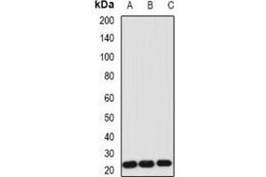 Western blot analysis of IL-1RA expression in Hela (A), NIH3T3 (B), HL60 (C) whole cell lysates. (IL1RN 抗体)