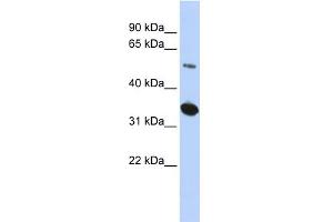 WB Suggested Anti-KIAA0157 Antibody Titration: 0. (FAM175B 抗体  (Middle Region))