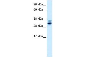 WB Suggested Anti-ZNF654 Antibody Titration:  0. (ZNF654 抗体  (Middle Region))