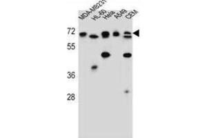 Western Blotting (WB) image for anti-acetylserotonin O-Methyltransferase-Like (ASMTL) antibody (ABIN2997228) (ASMTL 抗体)