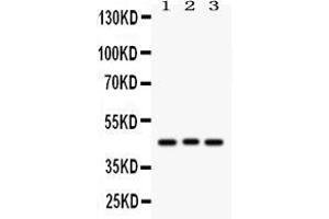 Western blot analysis of Ataxin 3 using anti-Ataxin 3 antibody . (Ataxin 3 抗体  (C-Term))