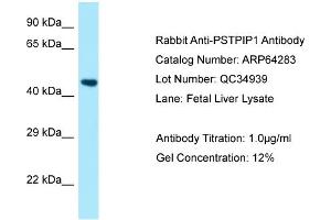 Western Blotting (WB) image for anti-Proline-serine-threonine Phosphatase Interacting Protein 1 (PSTPIP1) (N-Term) antibody (ABIN2789789) (PSTPIP1 抗体  (N-Term))