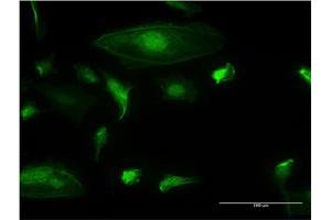 Immunofluorescence (IF) image for anti-TRIM17 / RNF16 (TRIM17) (AA 75-184) antibody (ABIN526476)