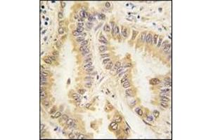 Immunohistochemistry (IHC) image for anti-Superoxide Dismutase 2, Mitochondrial (SOD2) antibody (ABIN356396) (SOD2 抗体)