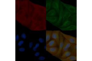 Annexin A2 Mouse Monoclonal Antibody staining Hela cells by IF/ICC. (Annexin A2 抗体  (Internal Region))