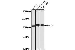 Western blot analysis of extracts of various cell lines, using PRKCB antibody (ABIN6128462, ABIN6146199, ABIN6146201 and ABIN6217699) at 1:1000 dilution. (PKC beta 抗体  (AA 1-270))