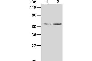 Western Blot analysis of Hela and 293T cell using AKR1B1 Polyclonal Antibody at dilution of 1:350 (AKR1B1 抗体)