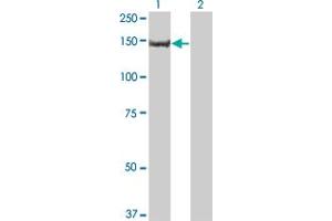 Western Blot analysis of PIK3R4 expression in transfected 293T cell line by PIK3R4 monoclonal antibody (M03), clone 1G12. (PIK3R4 抗体  (AA 1259-1358))