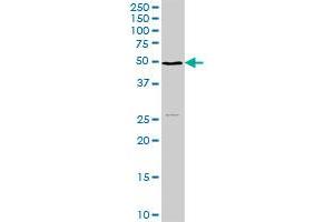 NSDHL MaxPab rabbit polyclonal antibody. (NSDHL 抗体  (AA 1-373))
