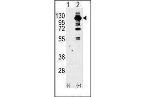 Image no. 1 for anti-Phosphoinositide-3-Kinase, Catalytic, gamma Polypeptide (PIK3CG) (Middle Region) antibody (ABIN360713) (PIK3 gamma 抗体  (Middle Region))