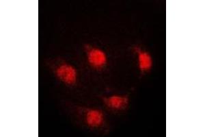 Immunofluorescent analysis of STAT5A staining in K562 cells. (STAT5A 抗体  (Center))