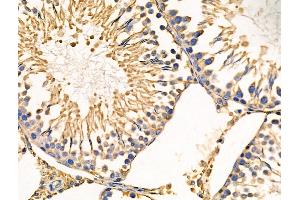 ABIN6258097 and ABIN6274226 at 1/100 staining Rat testis tissue by IHC-P. (PPIF 抗体  (Internal Region))