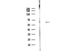 Western blot analysis of lysates from Mouse testis, using SERPIN Antibody at 1/1000 dilution.