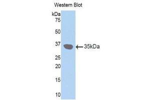 Western Blotting (WB) image for anti-Gap Junction Protein, beta 3, 31kDa (GJB3) (AA 210-270) antibody (ABIN1174655) (Connexin 31 抗体  (AA 210-270))