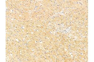 ABIN7094740 and ABIN7098791 at 1/100 staining Rat heart tissue by IHC-P. (DAB2IP 抗体  (C-Term))