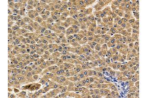 ABIN6256887 and ABIN6274764 at 1/100 staining rat liver tissue by IHC-P. (TROVE2 抗体  (N-Term))