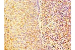 Immunohistochemistry of paraffin-embedded human tonsil tissue using ABIN7144328 at dilution of 1:100 (TAP1 抗体  (AA 524-808))