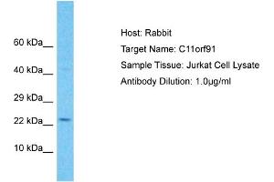 Host: Rabbit Target Name: C11orf91 Sample Type: Jurkat Whole Cell lysates Antibody Dilution: 1. (C11orf91 抗体  (C-Term))